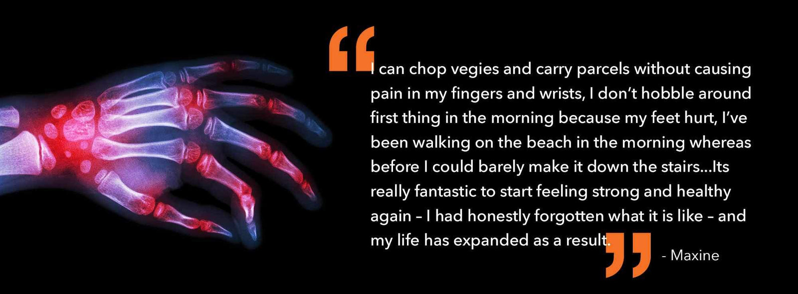 Naturally Relieving Rheumatoid Arthritis Symptoms